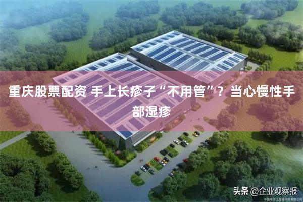 重庆股票配资 手上长疹子“不用管”？当心慢性手部湿疹