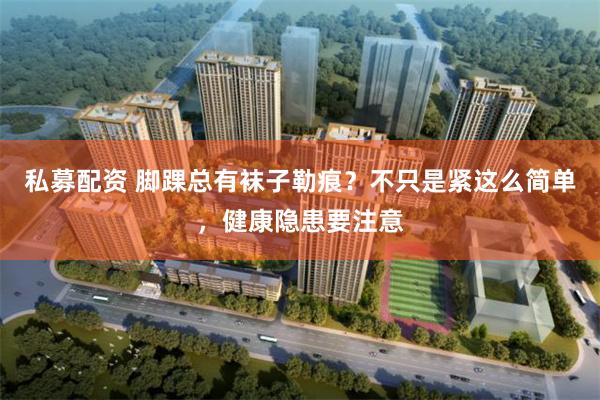 私募配资 脚踝总有袜子勒痕？不只是紧这么简单，健康隐患要注意